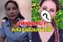 อัพเดตหน้าแหม่ม วิชชุดา หลังศัลยกรรมมา5เดือน ล่าสุดเป็นแบบนี้ไปแล้วจ้า..!