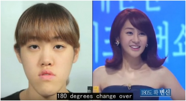 สาวเกาหลีคนนี้ได้รับการยอมรับว่าศัลยกรรมได้ดูดีที่สุด!