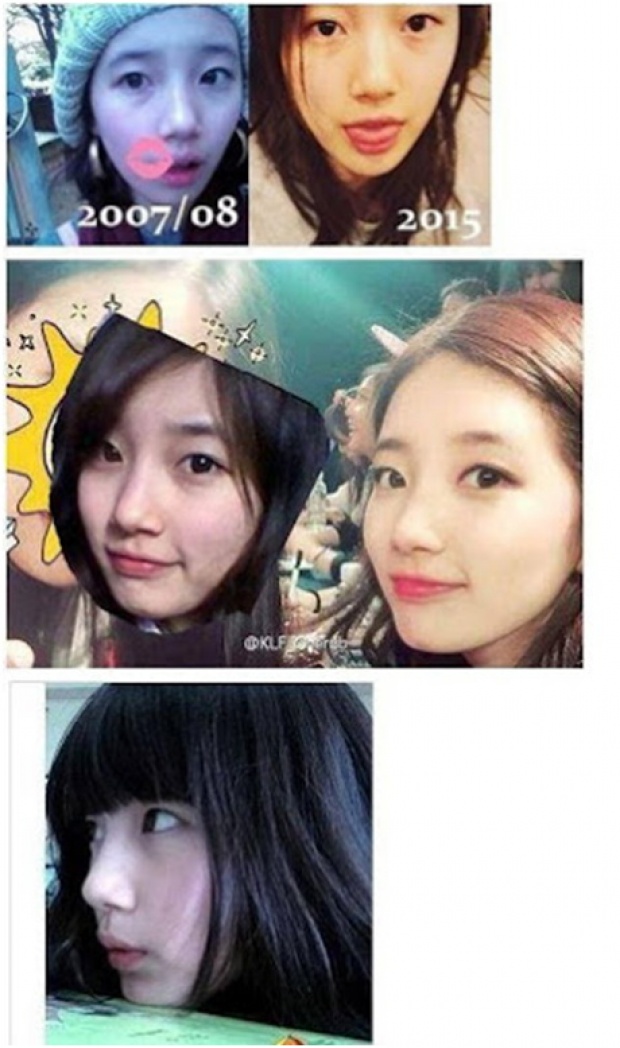 เนติเซนงัดหลักฐานกล่าวหาว่า ซูจี miss A ผ่านการทำศัลยกรรมพลาสติกมา!!