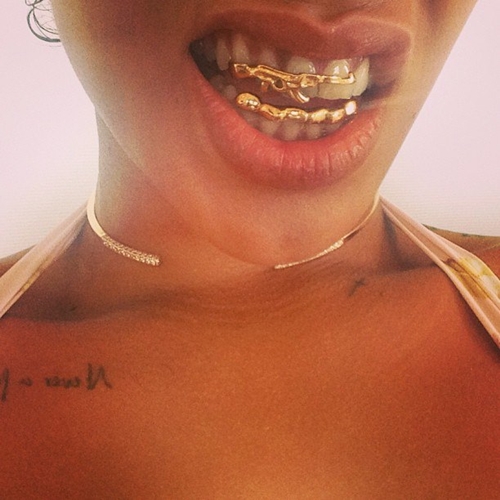 ฟันสีทอง