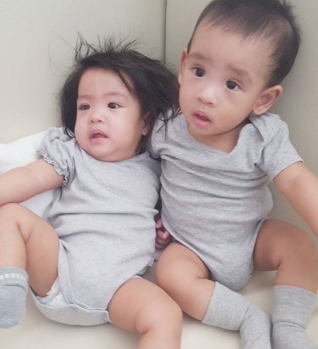 เป็นกำลังใจ น้องอลิน เตรียมผ่าตัดทำบอลลูน หัวใจ แล้ว