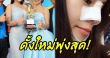 แฟนคลับตกใจแรง! นักร้องชื่อดัง ตัดสินใจเสริมจมูก ผลที่ออกมาเรียกได้พุ่งสุดๆ!