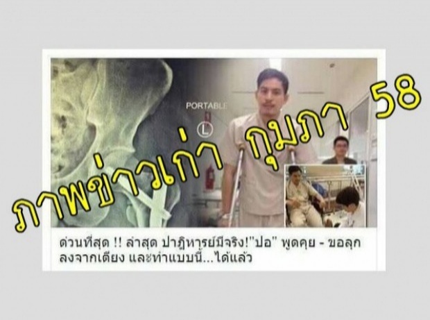 วอนหยุดแชร์ ภาพเก่าปอฝึกเดิน-เริ่มกายภาพบำบัด