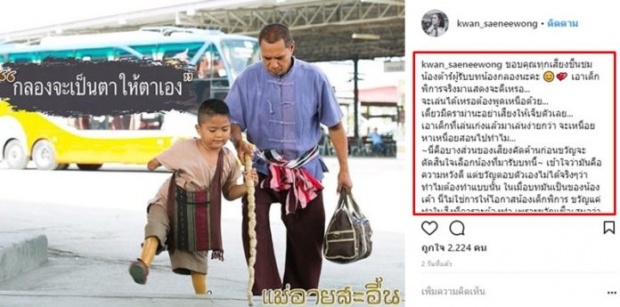 น้ำตาท่วมจอ!! “น้องต้าร์” ลูก “ปุ๊กลุก” พิการจริง ตีบทแตก!! ขอบคุณที่ให้โอกาส (มีคลิป)