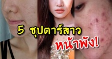 เผยโฉมชัดๆ! 5ซุปตาร์สาว ดีกรีระดับ นางเอก-นักร้อง แต่เคยหน้าพัง สิวเขรอะ!