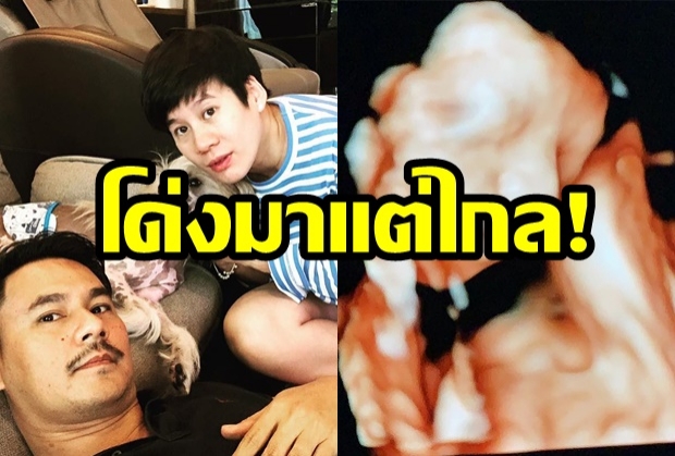  “เวฟ-บุ้ง” เปิดภาพอัลตราซาวด์ “น้องบุญ“ จมูกโด่งมาก!