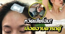 หวิดเสียโฉม! ดาราสาวสุดแซ่บ เลือดอาบคารถตู้ เร่งนำตัวส่งรพ.กันวุ่น