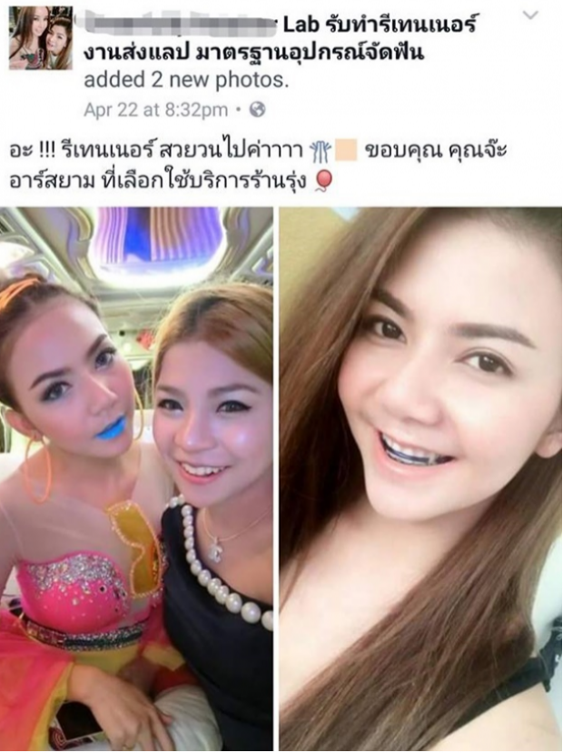 “จ๊ะ อาร์สยาม” งานงอกแน่ๆ ช่วยโปรโมทรีเทนเนอร์ ทันตแพทยสภา ชี้คลินิกเถื่อน!