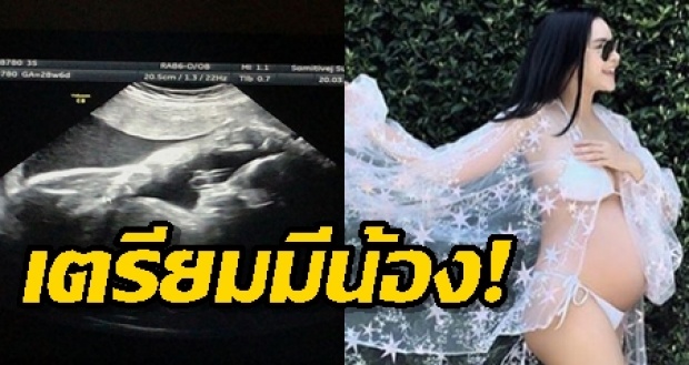 น้องเจ้าขา เตรียมมีน้องแล้ว!! กระเเต เผยภาพอัลตราซาวด์ลูกคนที่ 2