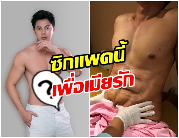 กลัวเซ็กส์เสื่อม! แมน-การิน ย่องหาหมอดัง ทำซิกแพคเอาใจเมียรัก