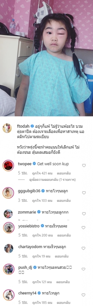 แฟนคลับใจหาย น้องชูใจ หน้าบวมตุ่ยตาปิด ไม่ทราบสาเหตุ