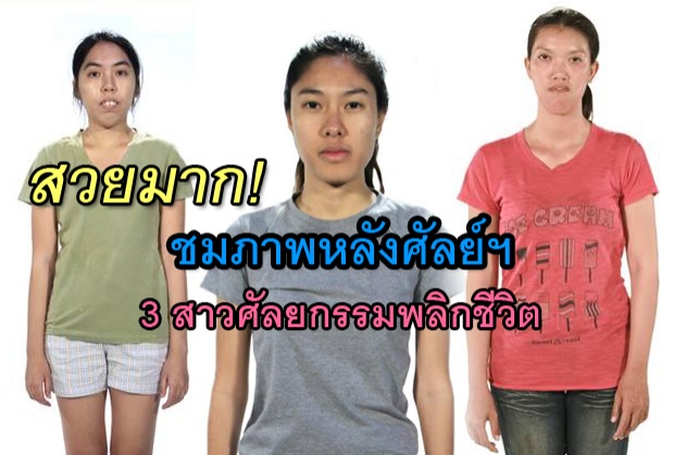 ชมภาพหลังศัลย์ฯของ 3 สาวศัลยกรรมพลิกชีวิต บอกเลยว่า ปัง X 3!