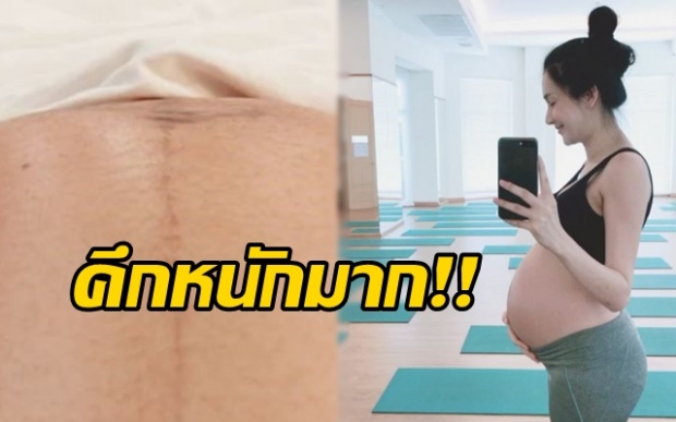 “เนย โชติกา” โพสต์คลิปล่าสุด ลูกน้อย คึกหนักมาก!! สงสัยใกล้จะออกมาแล้ว!! (มีคลิป)