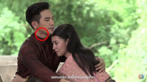 ซูมกันตาแตก!! รอยปริศนาที่ต้นคอของ พี่หมื่นโป๊ป รอยอะไร!?