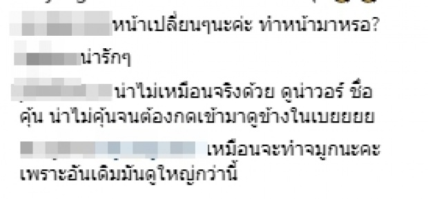 แชร์สนั่น! ภาพนางเอกสาวชื่อดัง ช่องใหญ่ หน้าบวมเป่ง! โดนจับผิดทำศัลยกรรม จนหน้าเปลี่ยน?!