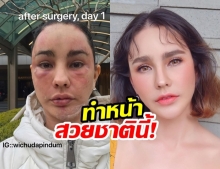 สวยกระชากวัย! แหม่ม วิชุดา รีวิวทำหน้าเกาหลี บอกเลยเป๊ะเว่อร์!