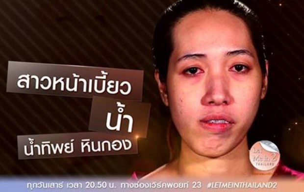 น้ำทิพย์ Let Me In Thailand 2 คนที่ 2 สาวหน้าเบี้ยว กลายเป็นสาวสวยเปรี้ยว