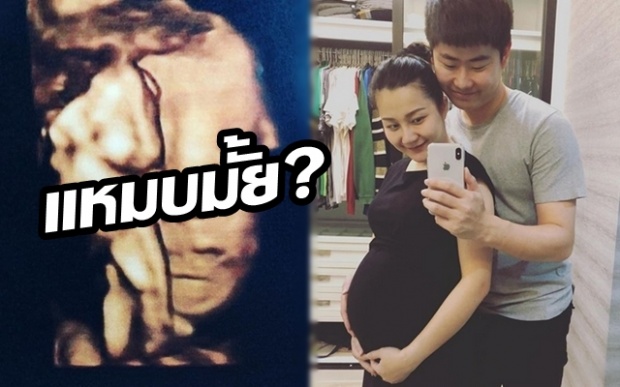 ห่วงหลานมาก!! “เอ็ม” ลูกสาว “หม่ำ” เผยภาพอัลตร้าซาวด์ลูก ยายรีบถามแหมบไหม?