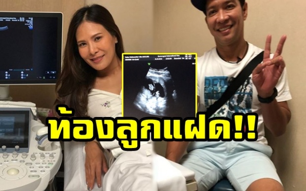 เหมือนปาฏิหาริย์? “หนุ่ม คงกะพัน” เผยข่าวดี!! โพสต์คลิปวินาทีสุดดีใจ หลังรู้ว่าภรรยาท้องลูกแฝด (มีคลิป)