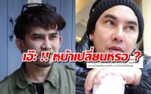 พจน์ อานนท์ ไปทำไรมาจนคนทักว่าหน้าเปลี่ยน !! เปลี่ยนหรอ ?