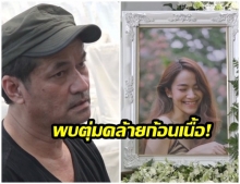 พ่อเผยแพทย์พบตุ่มคล้ายก้อนเนื้อในโพรงจมูก น้ำตาล รอผลตรวจ 1- 2 สัปดาห์