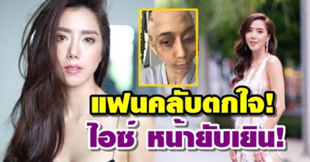 แฟนคลับตกใจ! หลังเห็นภาพ ไอซ์ อภิษฎา หน้ายับเยินขนาดนี้!? (คลิป)