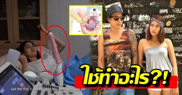 ไขข้อสงสัย! เครื่องมือใช้อัลตราซาวด์ลูก มาร์กี้-ป๊อก สิ่งนี้มีไว้ทำอะไร?!