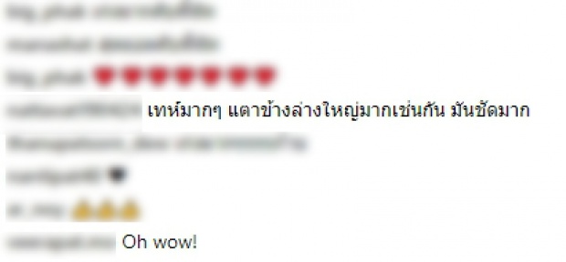 ณัฐ ศักดาทร กับสิ่งที่พกมาเต็มที่ในการวิ่ง.. ไม่รู้จะมองตรงไหนดี 