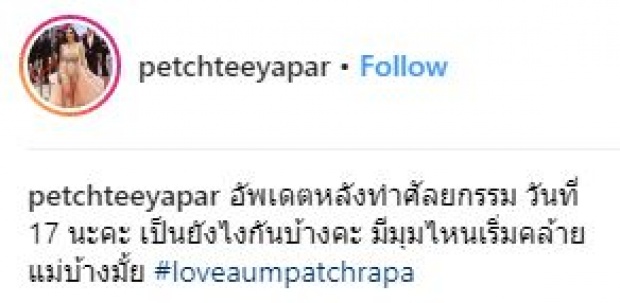 ส่องความเปลี่ยนแปลง “น้ำเพชร” หลังศัลยกรรม ล่าสุดเริ่มคล้าย “อั้ม พัชราภา” แล้ว!!!