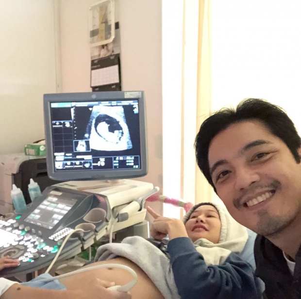 เผยเพศลูกแล้ว! “หนุ่ม ศรราม” ยิ้มแก้มปริ โชว์ผลตรวจเพศลูก สมดั่งใจคุณพ่อ