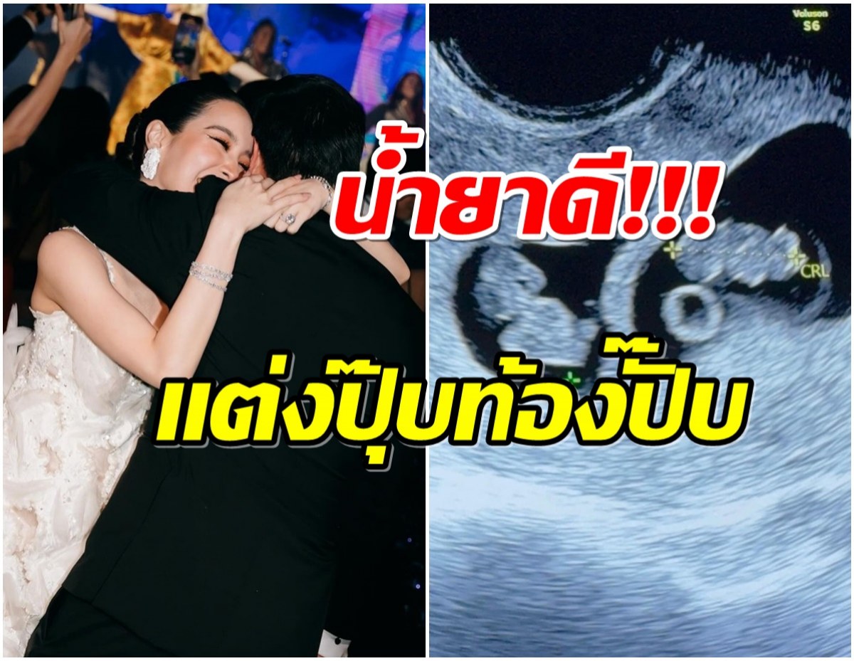 เพื่อนดาราเเห่ยินดี! คู่รักพันล้านประกาศตั้งท้องลูกเเฝดปีมังกร