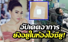 อัปเดตอาการ! เอมมี่ แม็กซิม ต้องถูกเจาะหลัง ยังอยู่ในห้องไอซียู