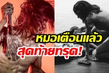 ก้อย เปิดสภาพ พี่ตูน หลังคอนเสิร์ต หมอเตือนแล้ว-สุดท้ายทรุด