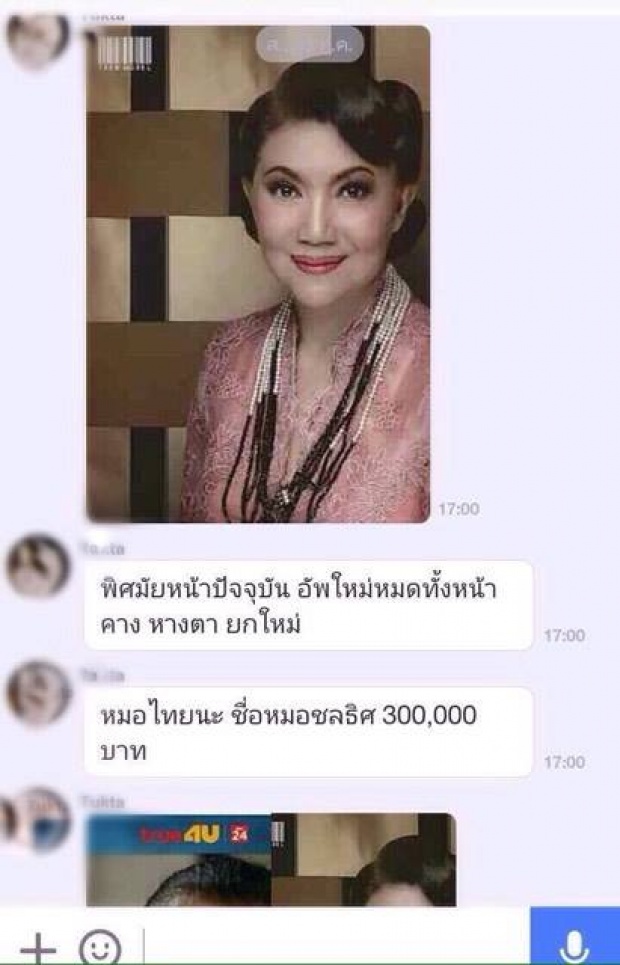 หือออ เปิดหน้าใหม่ “มี้ พิศมัย” ดาราอาวุโส ศัลยกรรมยกหน้ามา 3 แสน