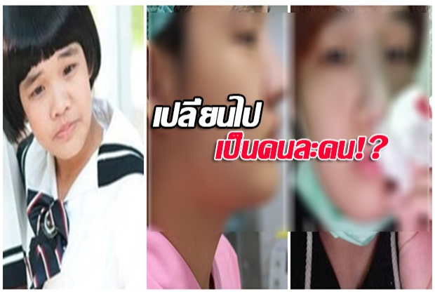  เปลี่ยนไปเป็นคนละคน!? จำได้ไหม น้องคิตตี้ อดีตดาราเด็ก ทำสวยศัลยจมูกใหม่