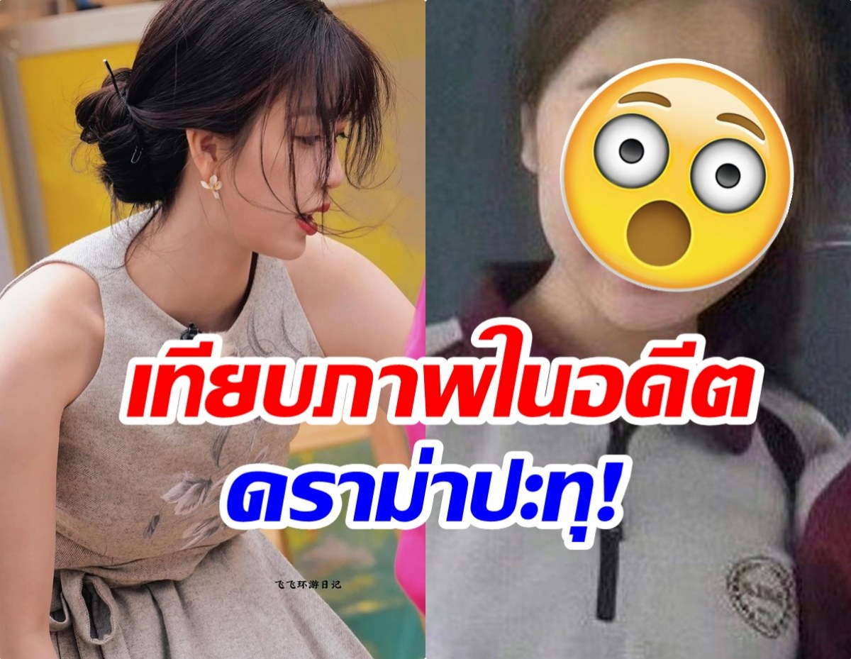 ซุปตาร์สาว งานเข้า! โดนอดีตเพื่อนสนิทเเฉประเด็นศัลยกรรม