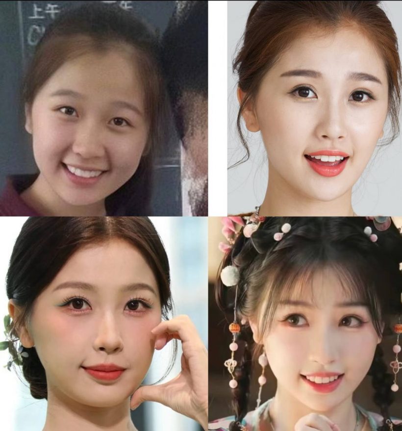 ซุปตาร์สาว งานเข้า! โดนอดีตเพื่อนสนิทเเฉประเด็นศัลยกรรม