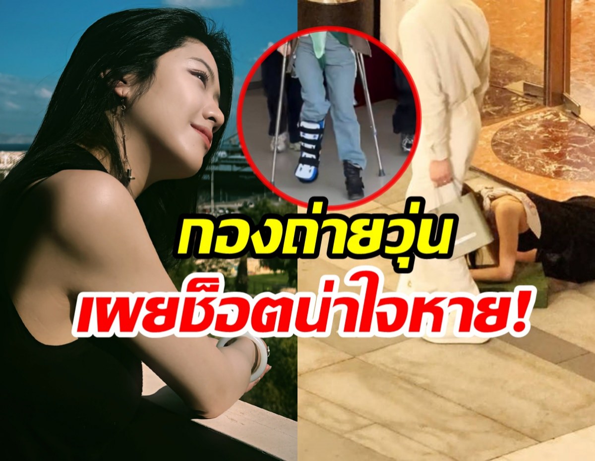 สุดห่วง! นางเอกดังสะดุดล้มหน้าคว่ำ ต้องใส่เฝือกอ่อน