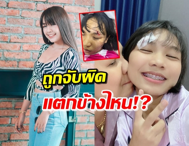 ‘เจนนี่’ ดักดราม่า! รูปแผลน้องสาวคนละข้าง แต่เจอจับผิดจนได้ 