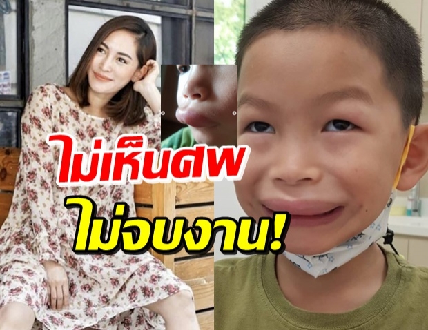 “พลอย” ตกใจ! “น้องพูม่า” ปากบวมเจ่อ ก่อนพบต้นเหตุคือ...!? (คลิป)