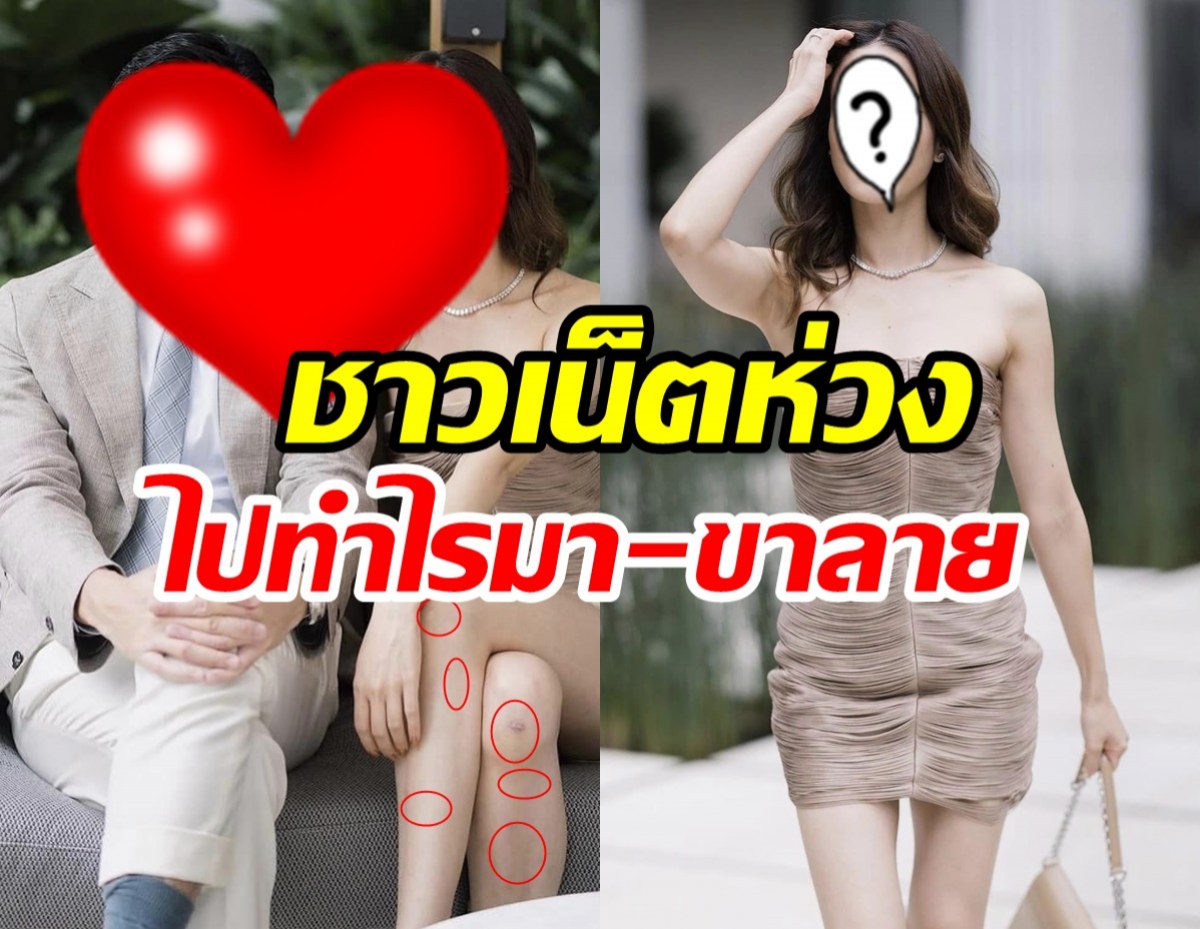 ไปทำอะไรมา?ขานางเอกคนดังใต้ภาพแอ๊วแฟน แย่งซีนไปหมด!