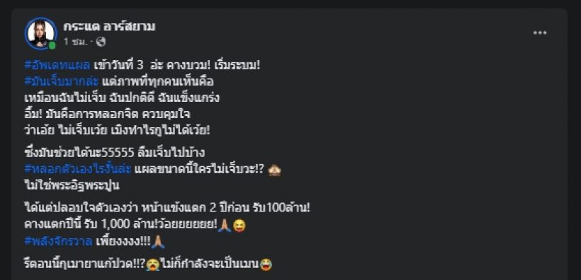 กระแต อาร์สยาม โชว์บาดแผลล่าสุด เข้าวันที่3แล้วเห็นแล้วตกใจ