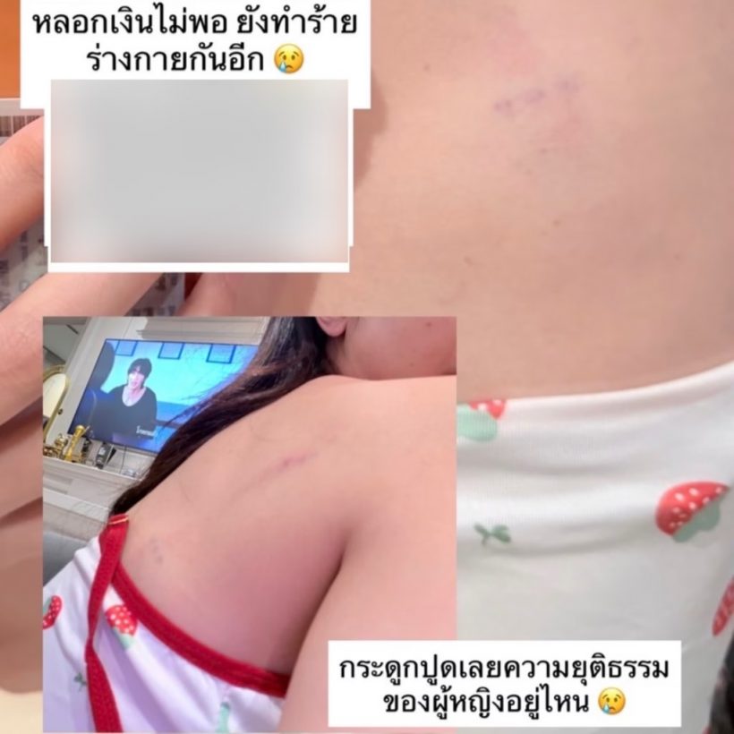 อินฟลูฯสาวเเฉเดือด! ถูกดาราหนุ่มช่องดัง ยืมเงิน-ทำร้ายร่างกาย