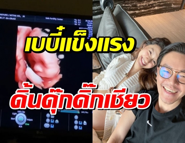 คุณแม่มิว อวดท้องโต โชว์คลิปเบบี๋แข็งแรงมาก ดิ้นดุ๊กดิ๊กในท้อง