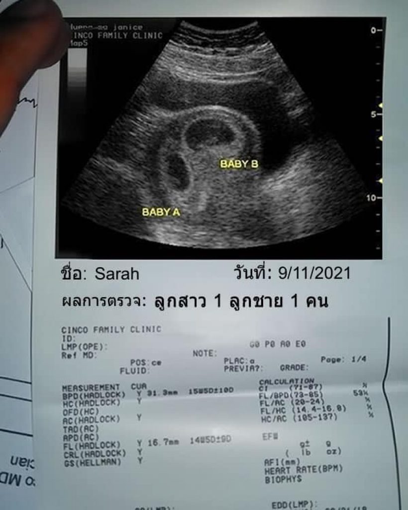 ซาร่าตอบชัดๆ มีลูกอีกไหม?หลังวันก่อนโชว์ภาพอัลตร้าซาวน์ชาย1หญิง1