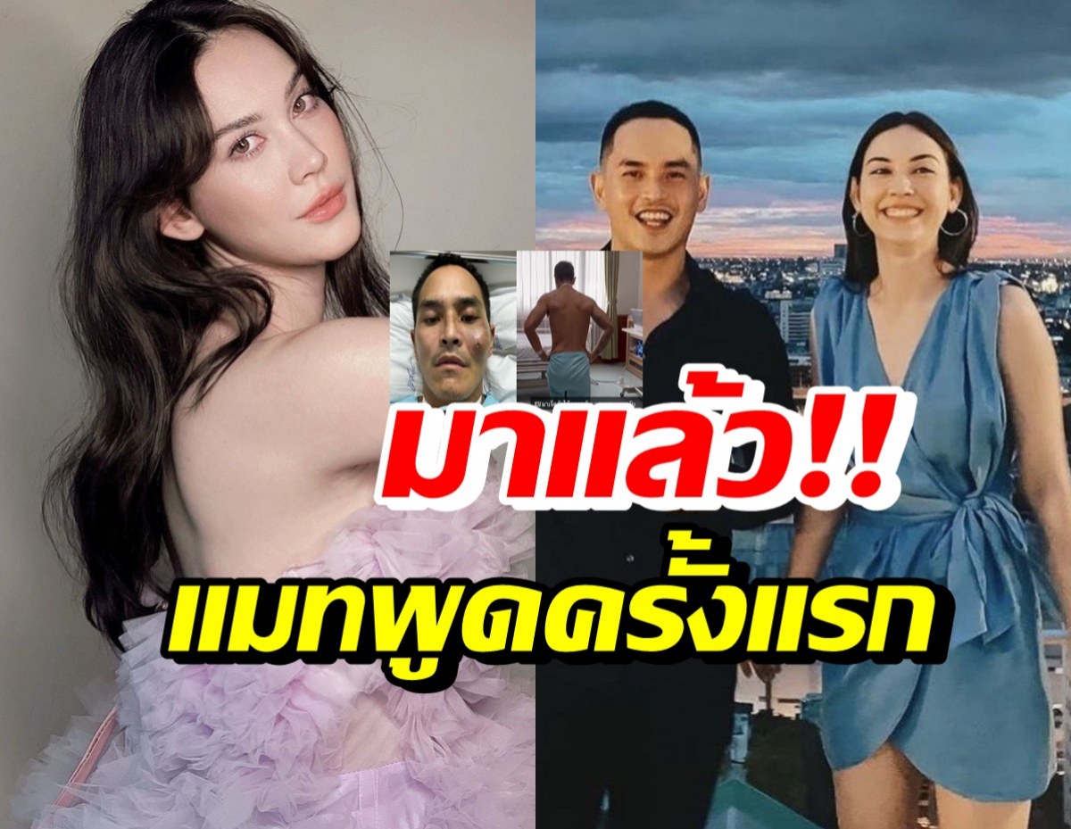 แมท ภีรนีย์ เปิดใจอาการป่วยสงกรานต์ หลังประสบอุบัติเหตุ 