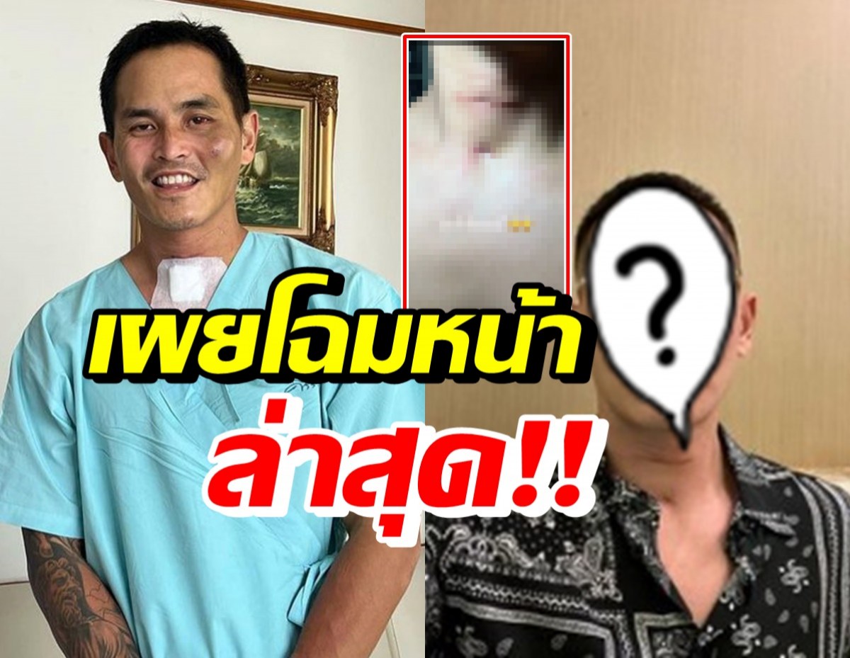 เปิดหน้าล่าสุด สงกรานต์ เตชะณรงค์ หลังประสบอุบัติเหตุเข้าICU 7 วัน