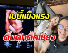 คุณแม่มิว อวดท้องโต โชว์คลิปเบบี๋แข็งแรงมาก ดิ้นดุ๊กดิ๊กในท้อง