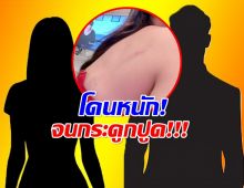 อินฟลูฯสาวเเฉเดือด! ถูกดาราหนุ่มช่องดัง ยืมเงิน-ทำร้ายร่างกาย