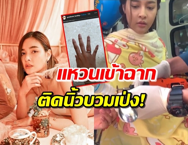 ‘ปุ๊กลุก’ งานเข้า! แหวนเข้าฉากติดนิ้วข้ามวัน นิ้วบวมเป่ง